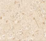 IL1F6 Antibody in Immunohistochemistry (Paraffin) (IHC (P))