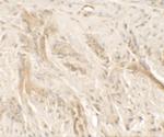 IL1F9 Antibody in Immunohistochemistry (Paraffin) (IHC (P))