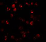 DNM1L Antibody in Immunocytochemistry (ICC/IF)