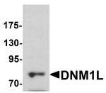 DNM1L Antibody in Western Blot (WB)