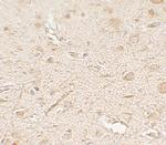 LAMTOR3 Antibody in Immunohistochemistry (Paraffin) (IHC (P))