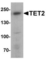 TET2 Antibody in Western Blot (WB)