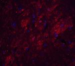 TET1 Antibody in Immunohistochemistry (Paraffin) (IHC (P))