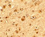 TET1 Antibody in Immunohistochemistry (Paraffin) (IHC (P))