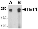 TET1 Antibody in Western Blot (WB)