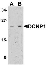 DCANP1 Antibody in Western Blot (WB)