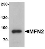 MFN2 Antibody in Western Blot (WB)