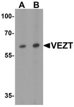 Vezatin Antibody in Western Blot (WB)