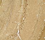 Ninjurin 1 Antibody in Immunohistochemistry (Paraffin) (IHC (P))