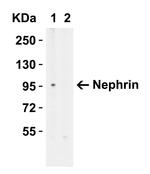 Nephrin Antibody in Western Blot (WB)