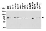 Nephrin Antibody in Western Blot (WB)