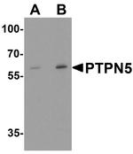 STEP Antibody in Western Blot (WB)