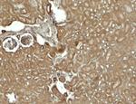 SESN2 Antibody in Immunohistochemistry (Paraffin) (IHC (P))