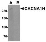 CaV3.2 Antibody in Western Blot (WB)