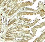 ADORA2B Antibody in Immunohistochemistry (Paraffin) (IHC (P))