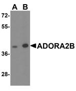 ADORA2B Antibody in Western Blot (WB)