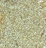 ADRM1 Antibody in Immunohistochemistry (Paraffin) (IHC (P))