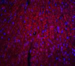 ARID1A Antibody in Immunohistochemistry (Paraffin) (IHC (P))