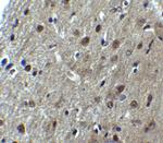 ARID1A Antibody in Immunohistochemistry (Paraffin) (IHC (P))