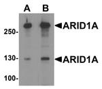 ARID1A Antibody in Western Blot (WB)