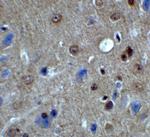 PACS1 Antibody in Immunohistochemistry (IHC)