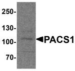 PACS1 Antibody in Western Blot (WB)