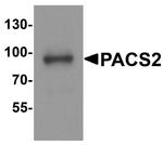 PACS2 Antibody in Western Blot (WB)