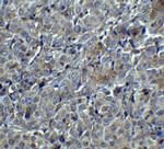 MAGEA4 Antibody in Immunohistochemistry (Paraffin) (IHC (P))