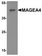 MAGEA4 Antibody in Western Blot (WB)