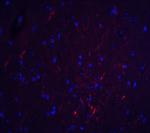 S1PR2 Antibody in Immunohistochemistry (Paraffin) (IHC (P))