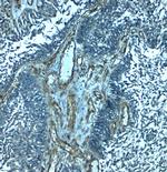 PALMD Antibody in Immunohistochemistry (Paraffin) (IHC (P))