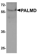 PALMD Antibody in Western Blot (WB)