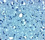 VTI1B Antibody in Immunohistochemistry (Paraffin) (IHC (P))