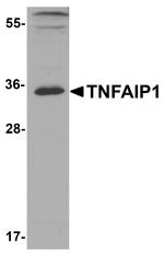 TNFAIP1 Antibody in Western Blot (WB)