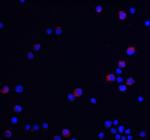 UBAP2L Antibody in Immunocytochemistry (ICC/IF)