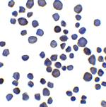 CHAD Antibody in Immunocytochemistry (ICC/IF)