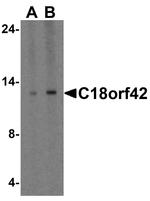 C18orf42 Antibody in Western Blot (WB)