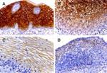 Caspase 14 Antibody in Immunohistochemistry (Paraffin) (IHC (P))