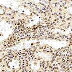 DEDD2 Antibody in Immunohistochemistry (Paraffin) (IHC (P))