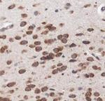 LAMTOR3 Antibody in Immunohistochemistry (Paraffin) (IHC (P))