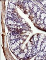 MCT1 Antibody in Immunohistochemistry (Paraffin) (IHC (P))