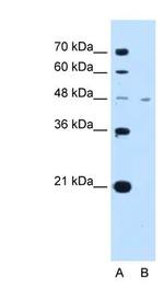 MCT1 Antibody in Western Blot (WB)