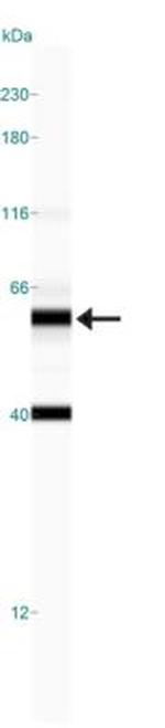 GLS2 Antibody in Western Blot (WB)