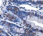 CHD7 Antibody in Immunohistochemistry (Paraffin) (IHC (P))