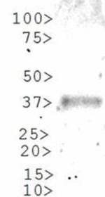 GLI1 Antibody in Western Blot (WB)