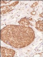 PIEZO2 Antibody in Immunohistochemistry (Paraffin) (IHC (P))