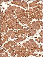 SETX Antibody in Immunohistochemistry (Paraffin) (IHC (P))