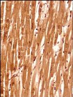 SETX Antibody in Immunohistochemistry (Paraffin) (IHC (P))