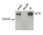 SETX Antibody in Western Blot (WB)