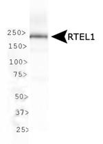 RTEL1 Antibody in Western Blot (WB)